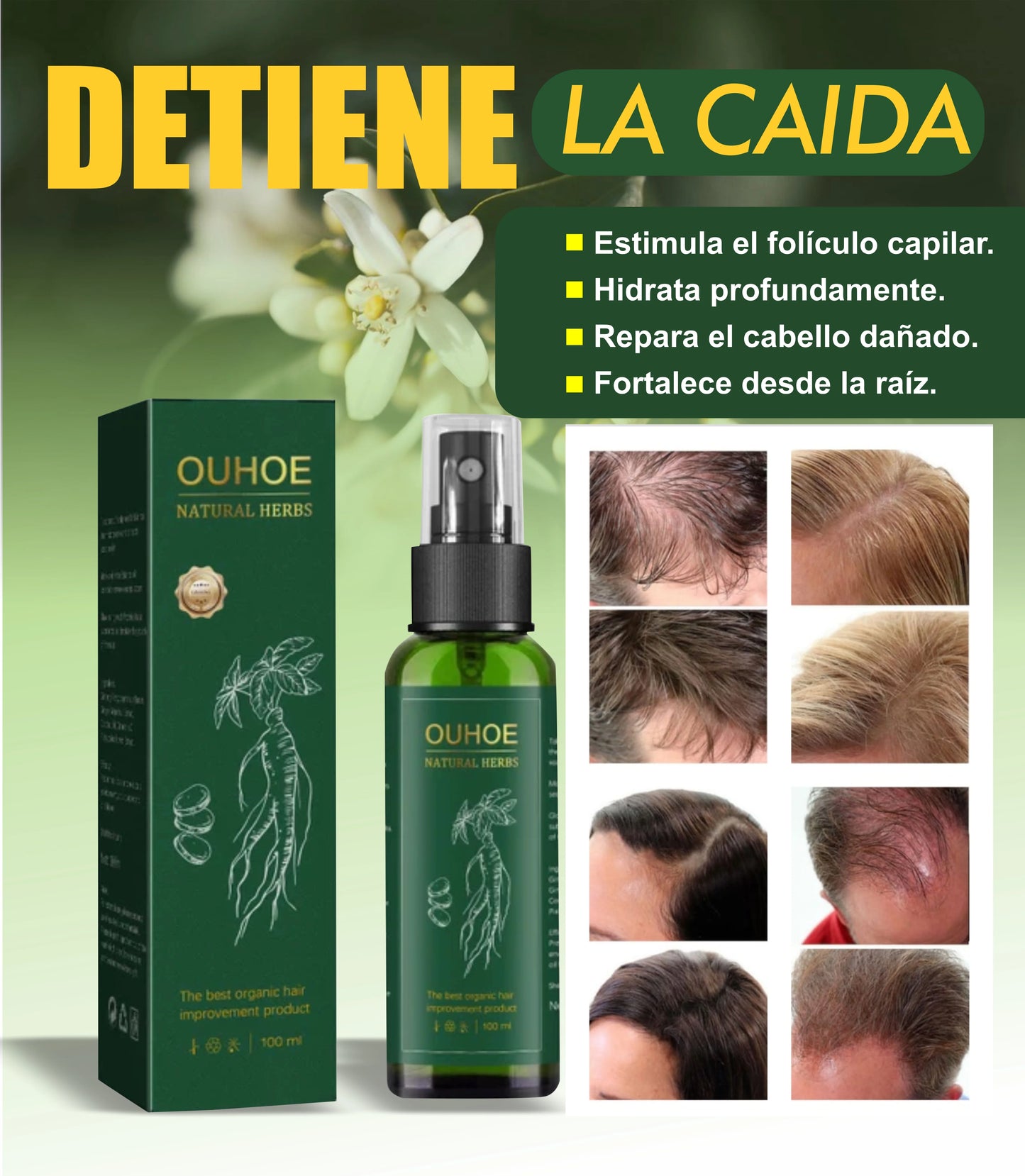 OUHOE™ Tónico Doble Acción 2x1 – Fortalece y Regenera tu Cabello